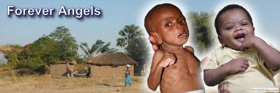Malnourished Children
