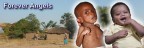 Malnourished Children